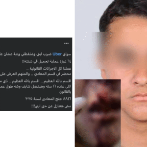 Uber Driver in Cairo Slashes 16-Year-Old Boy Over Payment Dispute, Leaving Him with 64 Stitches — Family Speaks Out, Uber Responds Uber Driver Slashes 15 Year Old Boy in Cairo Over Payment Dispute, Leaving Him with 64 Stitches — Family Speaks Out, Uber Responds